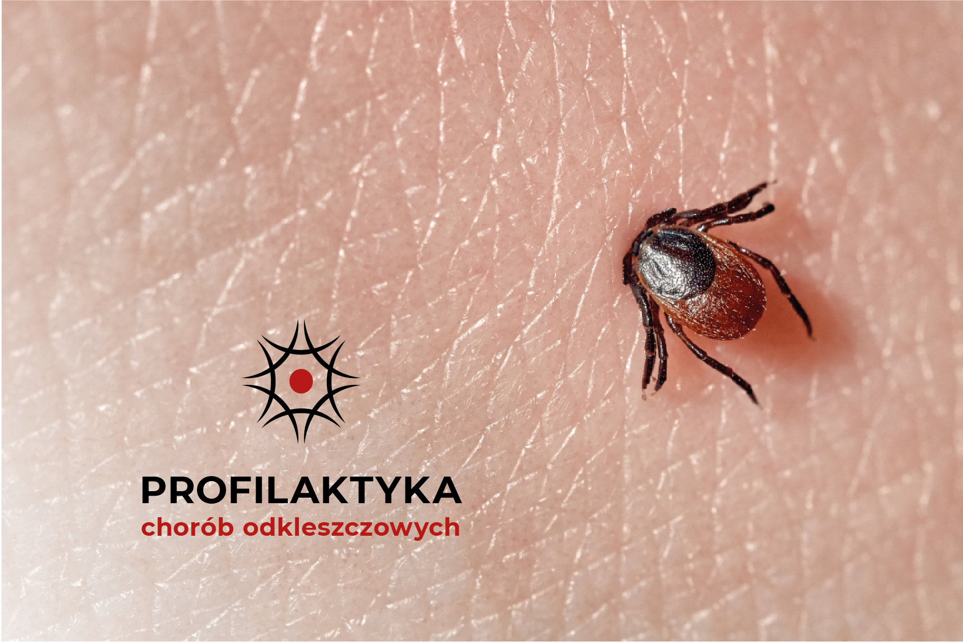 Przykładowa wizualizacja - Borelioza, Profilaktyka Chorób Odkleszczowych